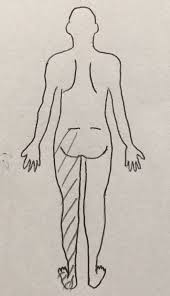 坐骨 神経痛 歩け ない 救急車