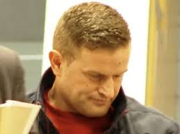 Francis Costello GoFundMe: Brother of man who lost eye in chemical attack  launches fundraiser