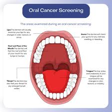 Image result for dental cancer