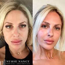 Through it all, I wouldn't have it any other way❤️ I truly hit the jackpot  when I got the chance to work with these ladies. I meant it then, and I mean