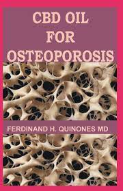 It seems there's an infinite number by the end, you will have a full understanding of how to use cbd oil and what to look out for when cbd oil for osteoporosis patients. Cbd Oil For Osteoporosis All You Need To Know About Using Cbd Oil For Treating Osteoporosis H Quinones Ferdinand 9781794237186 Amazon Com Books