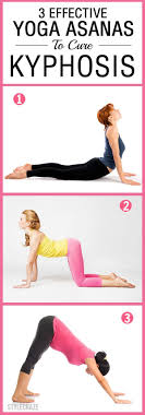 3 Effective Yoga Asanas To Cure Kyphosis Yoga Asanas Kyphosis Exercises Yoga Benefits