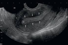 We did not find results for: Pelvic Ultrasound Chapter 7 Atlas Of Emergency Ultrasound