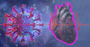 Learn about the diagnosis and treatment of this inflammation of the heart muscle that can affect the heart muscle and the heart's electrical system. Estudo Relaciona Virus Da Covid 19 No Coracao A Sindrome Rara Que Afeta Criancas Jornal Da Usp