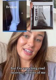 I Had The Worst Injury