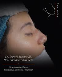 RINOPLASTIA EN MUJERES, ---, Nuestro objetivo principal es lograr la  armonía del rostro y, a la vez, conseguir una ventilación nasal óptima.,  ---, Existe una notable diferencia entre la rinoplastia ...