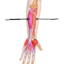 Check spelling or type a new query. Figure Flexor Digitorum Profundus Image Courtesy S Bhimji Md Statpearls Ncbi Bookshelf