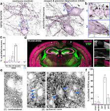 INF2-mediated actin filament reorganization confers intrinsic resilience to  neuronal ischemic injury | Nature Communications