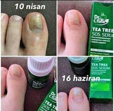 Dr C Tuna Tea Tree Serum 11 Tea Tree Tea Tree Oil Fragrance Tester