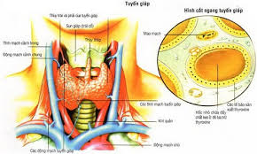 Hiện nay, các nhà khoa học vẫn chưa tìm thấy nguyên nhân chính thức gây bệnh nhưng họ tin rằng bức. Hiá»ƒu Ä'ung Carinoma Tuyáº¿n Giap La Gi Co Nguy Hiá»ƒm Hay Khong Medlatec