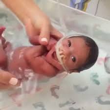 Learn the equipment you need and steps to take while giving your baby a bath, and how to keep your preemie warm during bath time. Send Us Your Nicu Bath Time Pictures From Mini To Moose