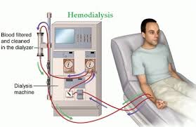 Bagaimana Penyakit Buah Pinggang Yang Kronik Pesakit Dialisis Boleh Mengelakkan Biasa Yang Berbahaya Dialysis Kidney Failure