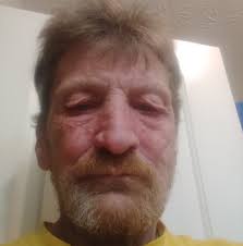 Who hires physically challenged carpenter Piece work or hourly