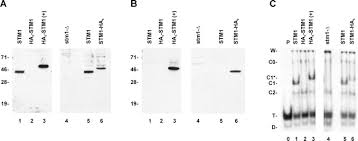 Places burlington, north carolina financial serviceloan service johnson & associates. Stm1p A G4 Quadruplex And Purine Motif Triplex Nucleic Acid Binding Protein Interacts With Ribosomes And Subtelomeric Y Dna In Saccharomyces Cerevisiae Journal Of Biological Chemistry