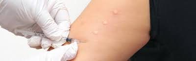 Analizy Na Allergiyu Na Antibiotiki