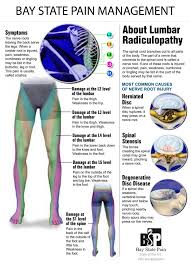 Pin On Radiculopathy