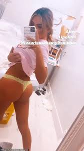 My mom asked me at doctors apoitment when she notice it and she ask me if it was a sign that im going to tattoe myself. Megan Barton Hanson Flaunts Her Peachy Behind As She Films Herself Getting Fat Reduction Treatment Aktuelle Boulevard Nachrichten Und Fotogalerien Zu Stars Sternchen