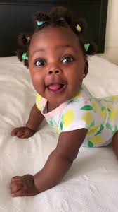 Displasia de Cadera en Bebés: ¡Gran Progreso a los 4 Meses!