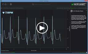 wpf ecg monitor chart demo fast native chart controls for