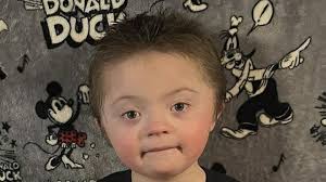 Fundraiser by James Tate : Help for Down Syndrome boy with medical issues