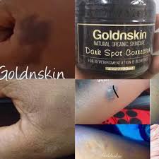 Spot Corrector Serum Scar Lightening Blemish Brightening Dark Spot Corrector Hyperpigmentation Serum Sepiwhite Arbutin Gigawhite Kojic In 2020 Dark Spot Corrector Dark Spots Lighten Skin