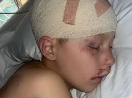 Fundraiser by Angelina Obi : Make little Jacob smile again having had brain  surgery