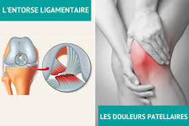 Quels sont les traitements médicaux à l'entorse ? Soccer Et Blessures Au Genou Prevention Et Traitements Oppq