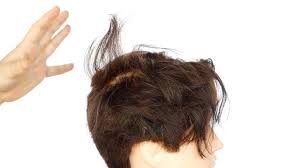 Fortunately, hair stylists and experts have found simple ways to address the issue, some of which require minimal effort for temporary fixes while some may need a little cash and commitment. How To Tame A Hair Cowlick Or Swirl Thesalonguy Youtube