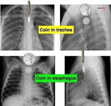Le bts imrt consiste à apprendre à traiter le patient avant le traitement, pendant le traitement et après le traitement ainsi qu'à rassurer le patient et lui prodiguer les soins nécessaires au trai. Manipulateur En Radiologie Home Facebook