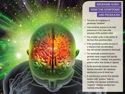 Résultat de recherche d'images pour "Migraine auras"
