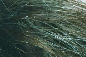 Although there have been no scientific studies into using eggs to boost hair growth, eggs are rich in protein which is needed to grow strong hair. Head Lice And Nits Nhs