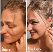 Hair growth spritz 10/10 recommend