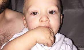 Anyone can get cancer — even babies. Cancer Symptoms This Photo Helped One Father Spot His Baby S Illness Express Co Uk