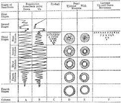 Schematic Chart Devised By Guedel In The First World War