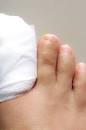 Surgery for ingrown toenails: Procedure, recovery, and risks