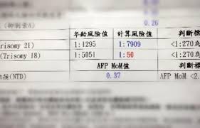 The site owner hides the web page description. ä»€éº¼ æ„› è‰¾å¾·è¯æ°ç—‡ å…§æœ‰è¨±å¤šå­•æœŸç›¸é—œæ–‡ç« åˆ†äº« åª½å'ªæ‹œmamibuy