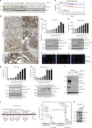 When signs of the disease start to appear, they can include: Rnf113a Expression In Lung Cancer And Upon Cisplatin Treatment A Download Scientific Diagram