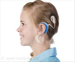 During a normal hearing process, sound waves enter the ear and vibrate the eardrum. Cochlear Implants Working Surgical Procedure Features Risks