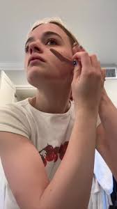 Any tips for the dermatitis would be greatly appreciated