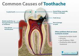 Pin On Dental Problems