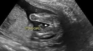 Banyak jugak cara orang nak tahu jantina baby 1) ikut perut melonjong(boy) ke membulat(girl) labels: Bila Boleh Tahu Jantina Baby Iman Abdul Rahim