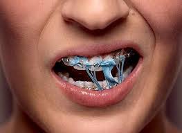 Maybe you would like to learn more about one of these? Halloween Despite Braces