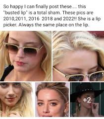 Saw this elsewhere & does anyone else agree that she's a lip picker, so  seemingly explains the "busted" lip