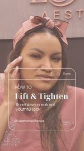 A thread lift is an excellent non-surgical option to restore your natural  beauty, while building lasting collagen in your skin. 🙌, Find out how  threads can work for you — DM us to reserve a ...