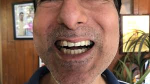 Million Dollar Smile in Malad West,Mumbai