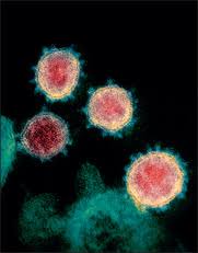 Enteric involvement of coronaviruses: is faecal–oral transmission of  SARS-CoV-2 possible? - The Lancet Gastroenterology & Hepatology