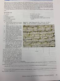 We did not find results for: Plant Cells Are Surrounded By A Rigid Cell Chegg Com