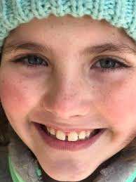 Childhood Cancer Awareness Night at the Royals