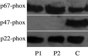 Check spelling or type a new query. Genetic And Molecular Findings Of 38 Iranian Patients With Chronic Granulomatous Disease Caused By P47 Phox Defect Tajik 2019 Scandinavian Journal Of Immunology Wiley Online Library
