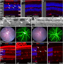 Targeting Hif1a Rescues Cone Degeneration And Prevents Subretinal Neovascularization In A Model Of Chronic Hypoxia Springerlink